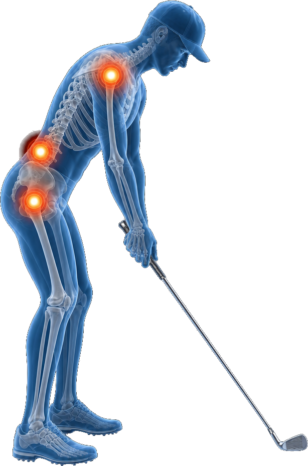 Anatomical illustration showing common recovery points for homeowners and their guests